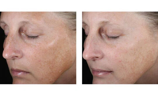 Signs of Aging Discovery Set