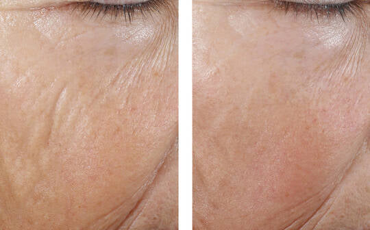 Signs of Aging Discovery Set