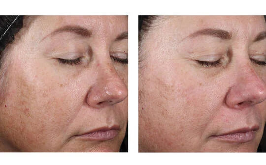 Signs of Aging Discovery Set