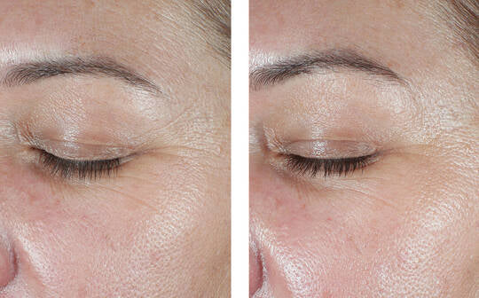 Signs of Aging Discovery Set