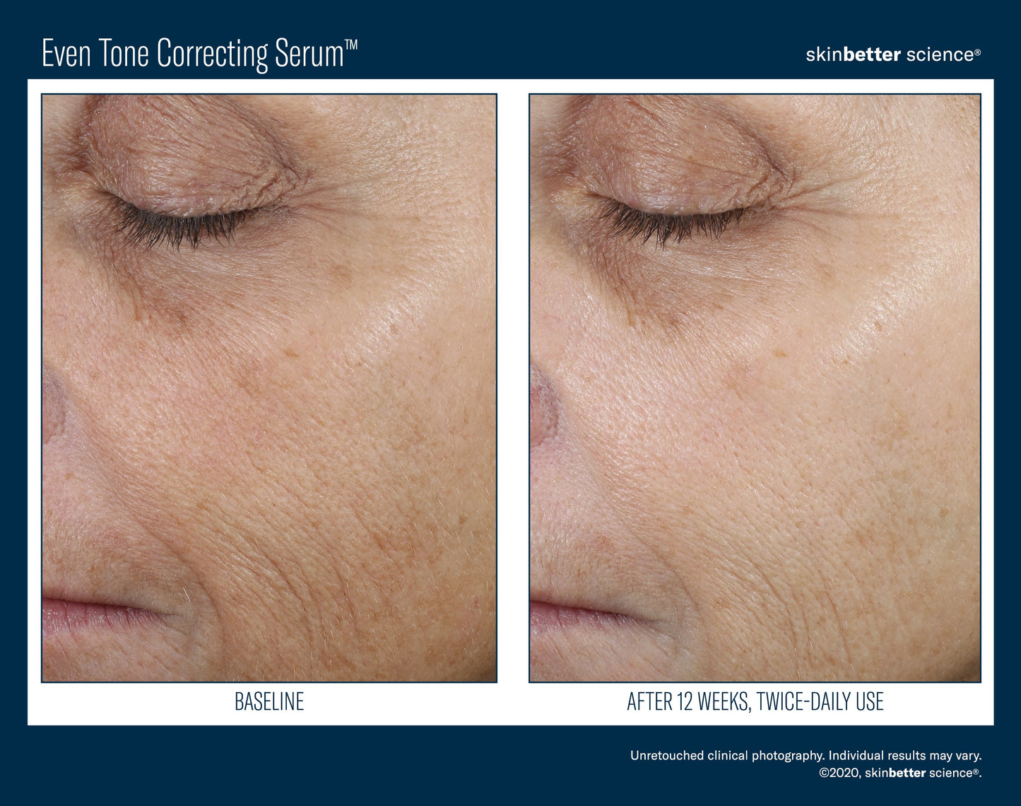 Even Tone Correcting Serum